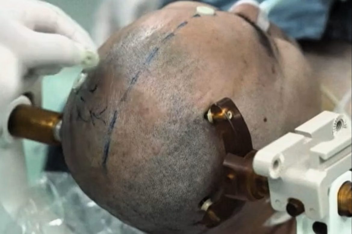 тархины суулгац